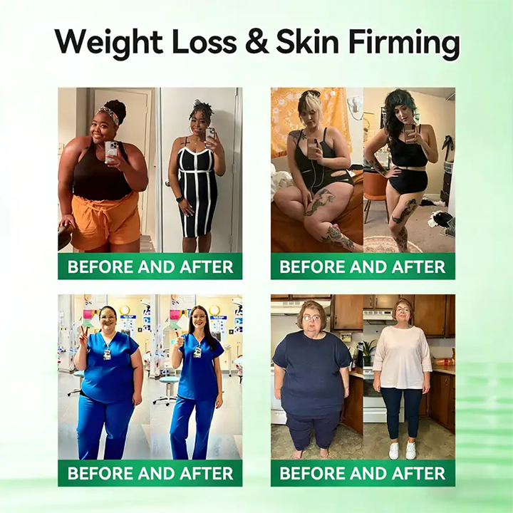 Timilk® Moringa 10-in-1 Metabolic Sculpting Cream
