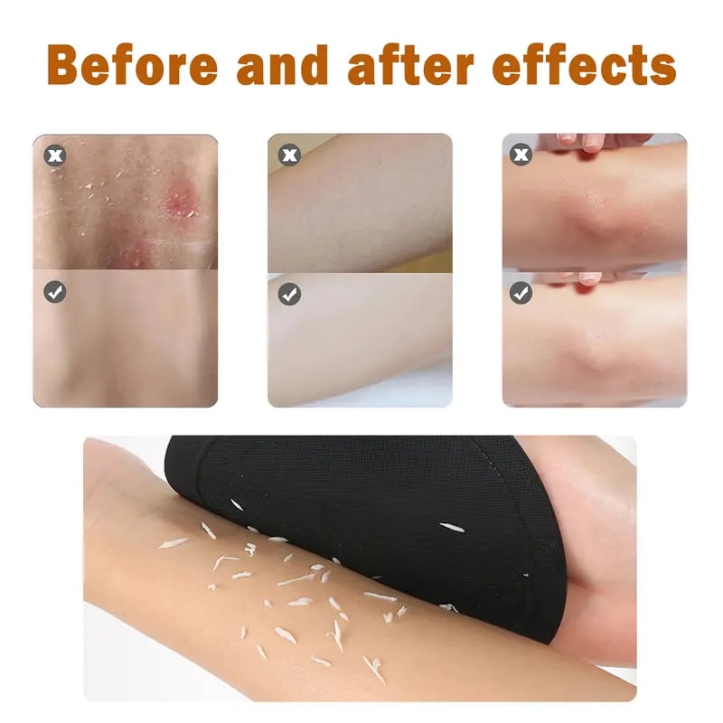 🧽 4-Pack Soft Rubber Shower Scrubber – Gentle Yet Effective. Exfoliates & Cleanses All Skin Types