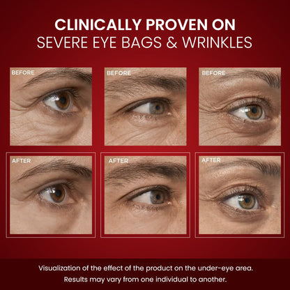 Luhaka® LumiLift Eye Bag Instant Eraser